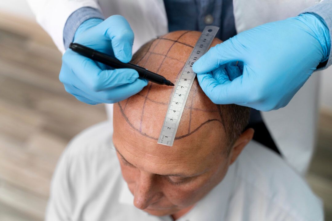Clínica Artisti oferece tratamentos capilares personalizados