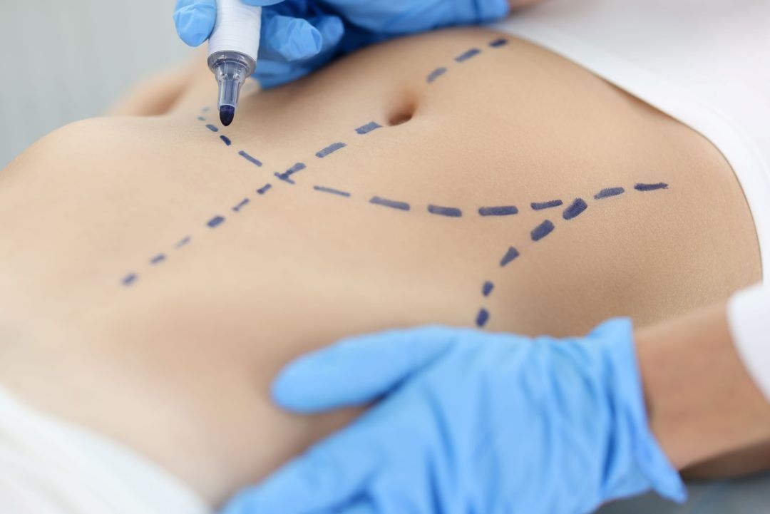 Cirurgia plástica: busca por resultado natural é tendência